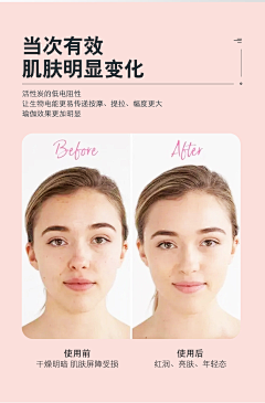 阿崽莹采集到智能面膜