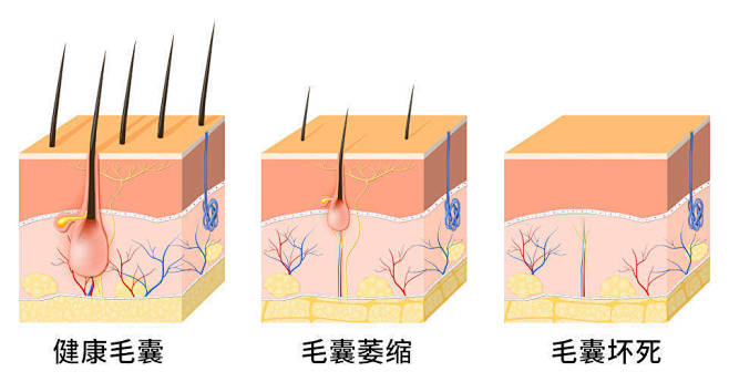 发根毛囊生长图的搜索结果_百度图片搜索