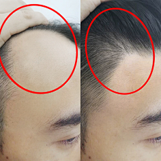 生发对比图-花瓣网|陪你做生活的设计师 | Fan_!!2201459910032.jpg (800×800)