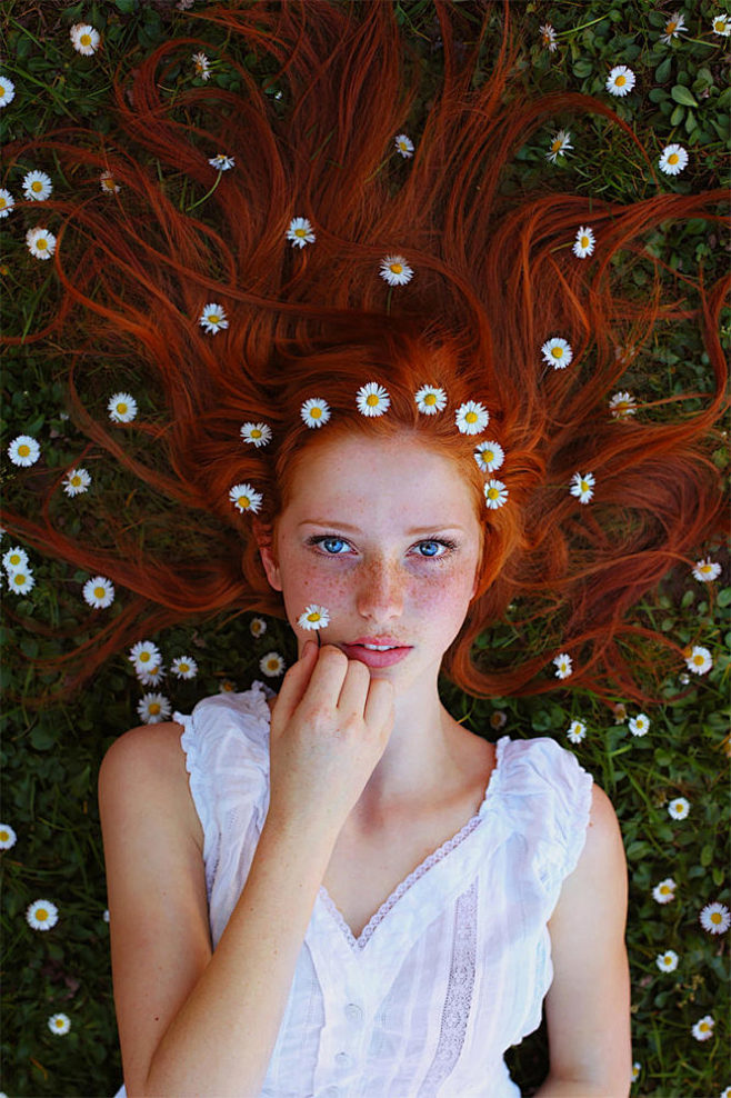 Freckles: Beauty Pho...