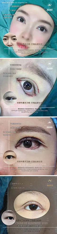 源文件下载【医美整形案例对比海报】编号：78660006461542816