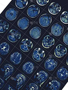 磁共振图像作为健康背景