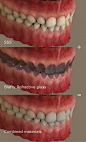 3D Teeth  Alex- Portrait of a Young Woman - Page 8: 