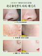 白泥清洁泥膜保湿面膜去黑头粉刺闭口收缩毛孔深层补水涂抹式男女-tmall.com天猫