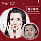 #眼鼻整形研讨周#
眼部案例分享
逆袭精致魅力大眼
变美从“眼”前开始
#北京艺星# #艺星整形# ​​​​