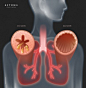 病理切片 肺部疾病 人体影像 医疗健康插画PSD54