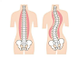 脊柱侧弯的搜索结果_360图片