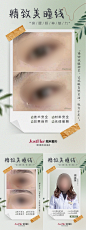 医美案例对比系列海报-素材库-sucai1.cn