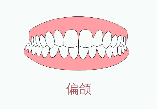 牙齿疾病 牙齿病变 牙黄 牙龈 整形牙齿...