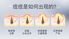 盐不闲＂采集到肌肤问题（痛点）