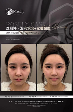 霏girl采集到案例水印