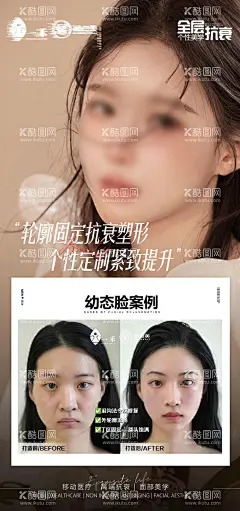 医美案例对比海报  - 源文件下载【酷图网】海报,整形,美容,医美,案例对比,幼态脸,人物,