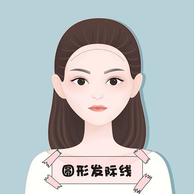 发际线 发际线类型 脱发 M型发际线 美人尖 参差不齐型发际线 圆形发际线 直方形发际线 种植发际线 脱发 半永久发际线 无痛植发 额角种植 ...