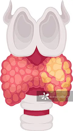 在白色背景上孤立的甲状腺人体器官图片素材