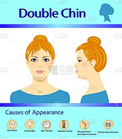 双下巴的成因，矢量图解