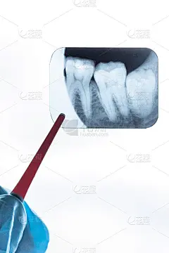 戴手套的牙医手持下弱智智齿的x光片