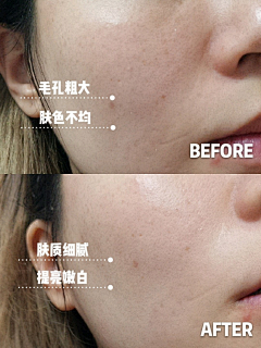~~huahua采集到案例