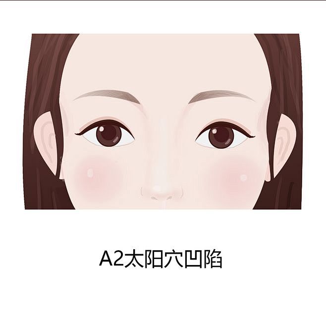 医美，脸型_戴超_【68Design】
