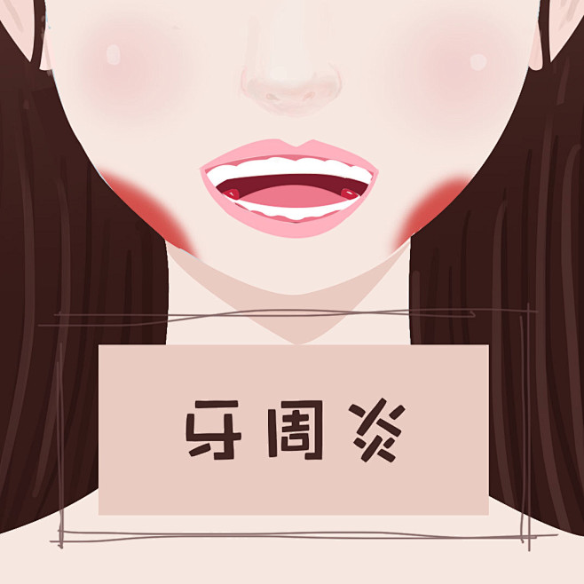 牙周炎
牙龈疾病 牙龈病变  牙龈出血 ...