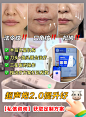 超声炮-1