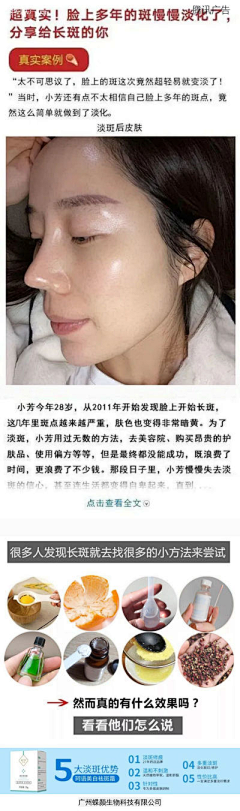 沙沙呀采集到祛斑