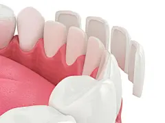  图片素材_图片ID：344316068