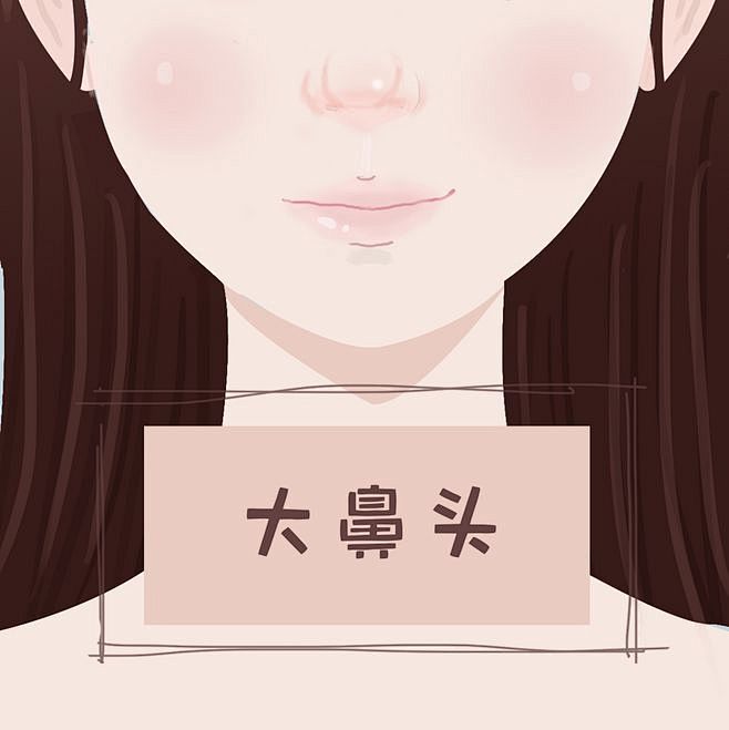 鼻子 鼻小柱 鼻子类型 鼻子分类 朝天鼻 波浪鼻 低鼻 歪鼻 大鼻孔鼻 大鼻头 鞍鼻 大鼻孔 鼻部综合 鼻梁短小 鼻根低平 鼻孔横卧 直鼻