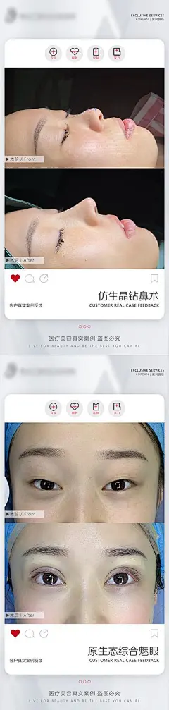 海报 医美 案例 模板 鼻子 眼睛 案例对比 医美案例对比
