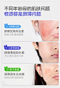 脸部痛点