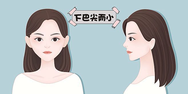 纠正下巴短小  纠正下巴后缩  纠正下巴.