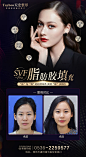 SVF脂肪胶填充