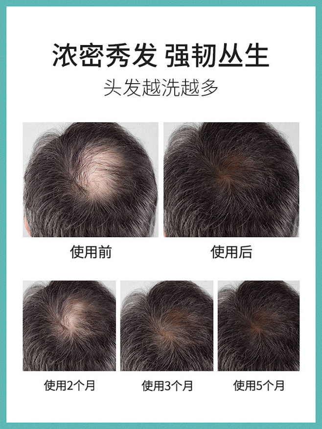 生姜洗发水防脱生发去屑止痒控油持久留香洗...