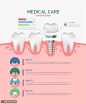 种植牙齿口腔美容步骤图片医疗插画医疗保健素材下载-优图网-UPPSD
