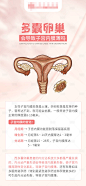 多囊卵巢会导致子宫内膜薄海报-设计素材-shejisc.cn
