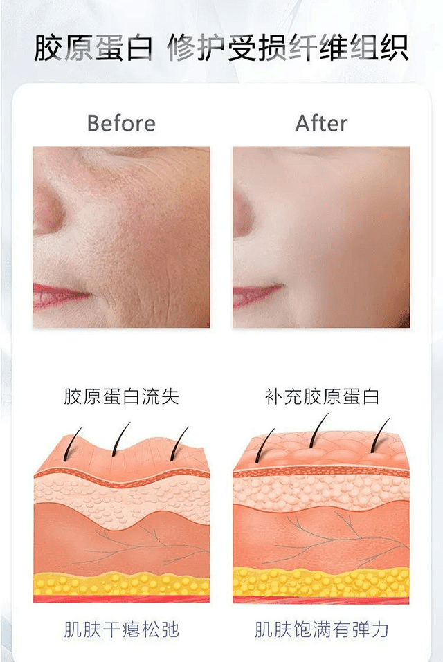 三型胶原蛋白是什么？有什么功效和作用？_人体_皮肤_操作 : 简单来说，三型胶原蛋白是给人体提供营养成分，促进人体胶原蛋白的生成，所以操作完成 ...