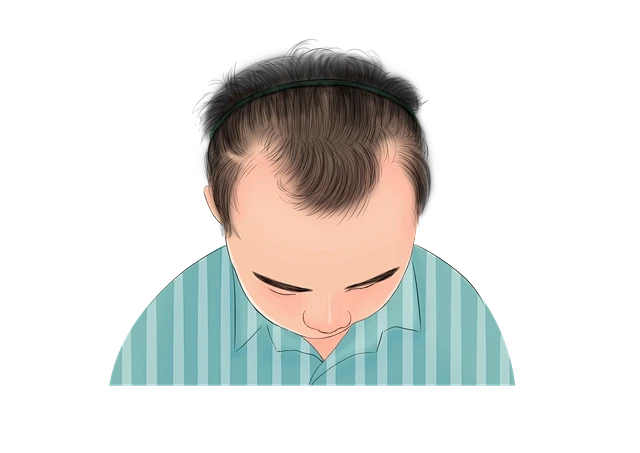 发际线M型后移，如何自救？