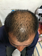 秃顶吧_百度贴吧