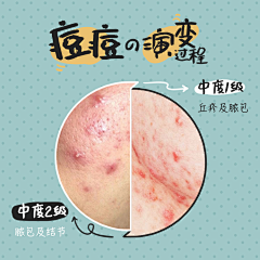压梨山大采集到我的护肤小知识