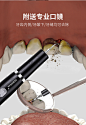 德国胖猫超声波洁牙机牙齿清洁器牙结石去除器自营智能儿童大人去牙渍菌斑口臭茶烟渍冲牙器刮洗白牙黑剔牙器 【魔力白】真超声波4头带灯+墙架+口腔镜+洁牙礼包【图片 价格 品牌 报价】-京东