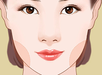 定向吸脂