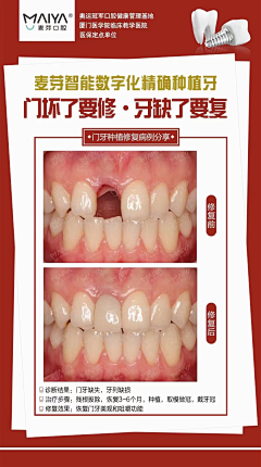 大魔王style采集到口腔