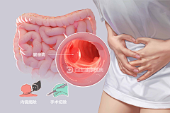 张张啊12138采集到胃肠镜科