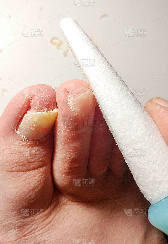 轮廓脚趾文件。在家修脚。