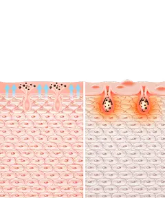 美妆系列插画风皮肤层状态差异对比图元素